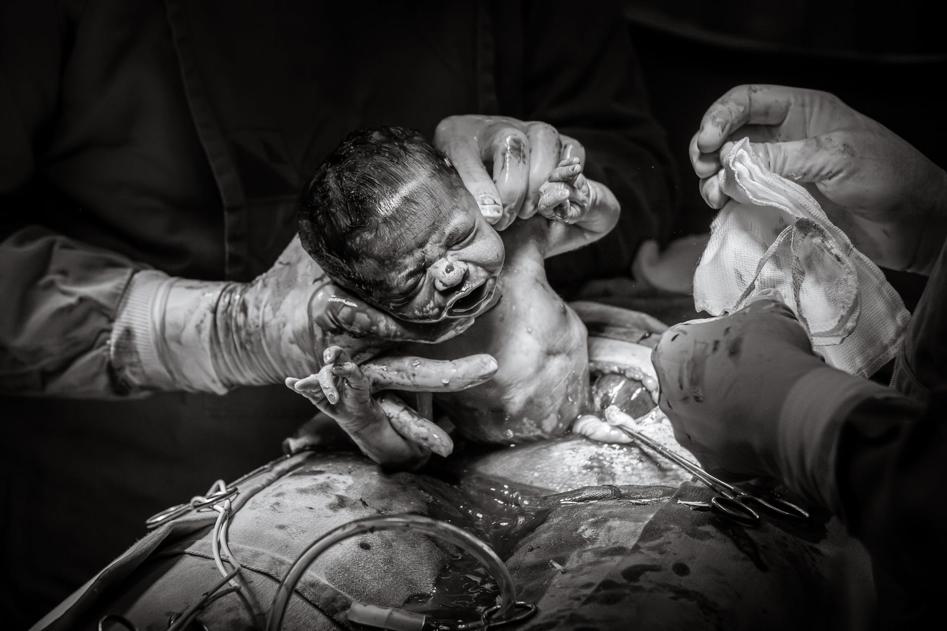 black and white photo of childbirth