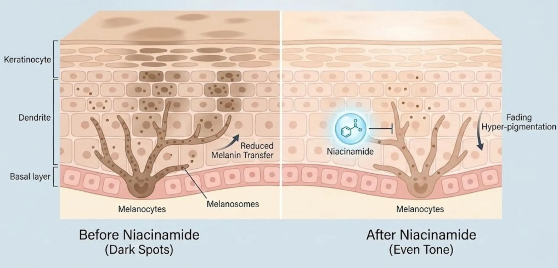 Niacinamide Blocking Melanin Transfer for Brighter Skin