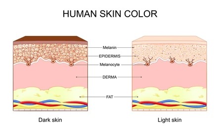 Melanin Production and Transfer: How Hyperpigmentation Develops