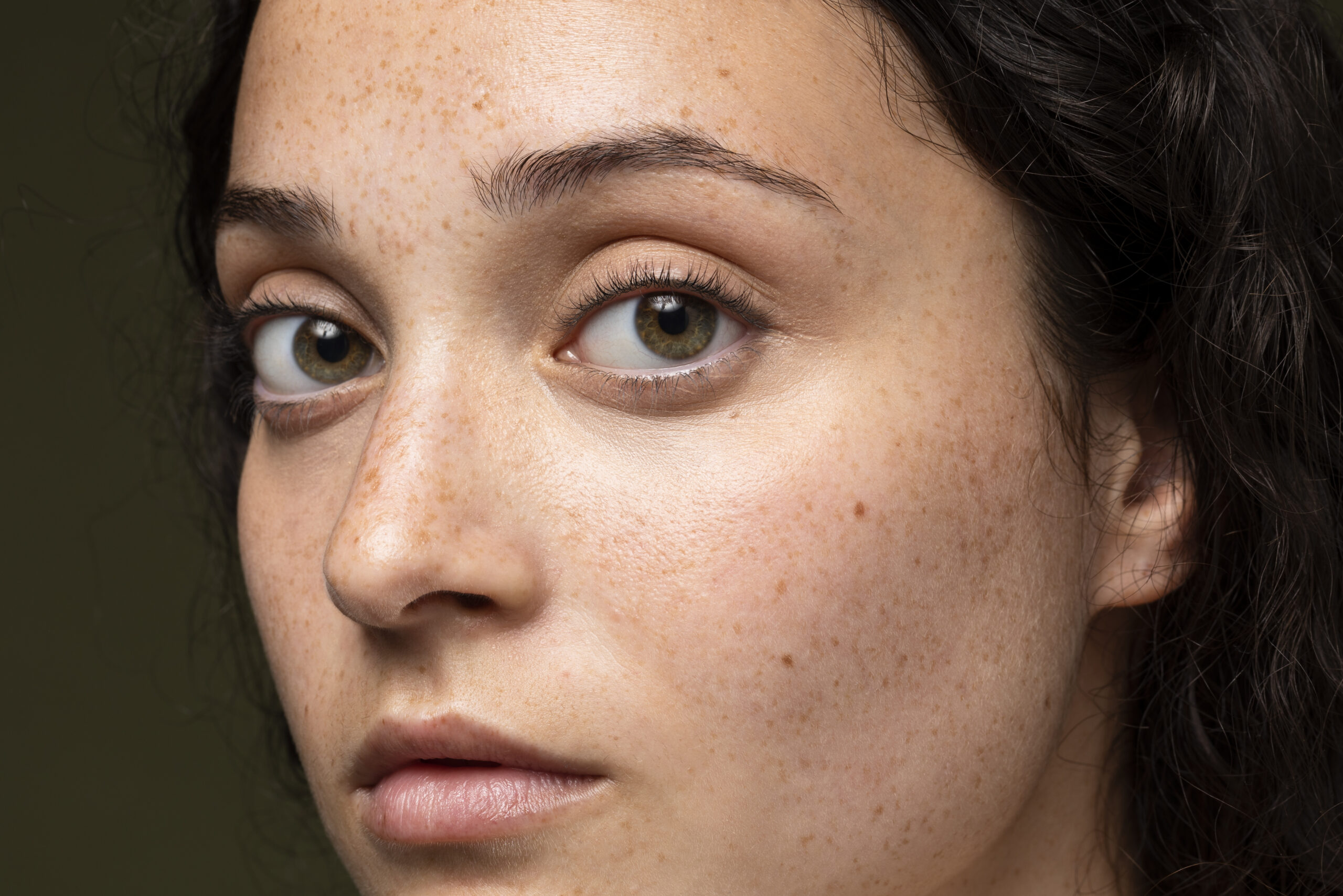 Pigmented skin spots caused by sun exposure, pollution, inflammation, and hormonal changes.